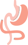 duodenal